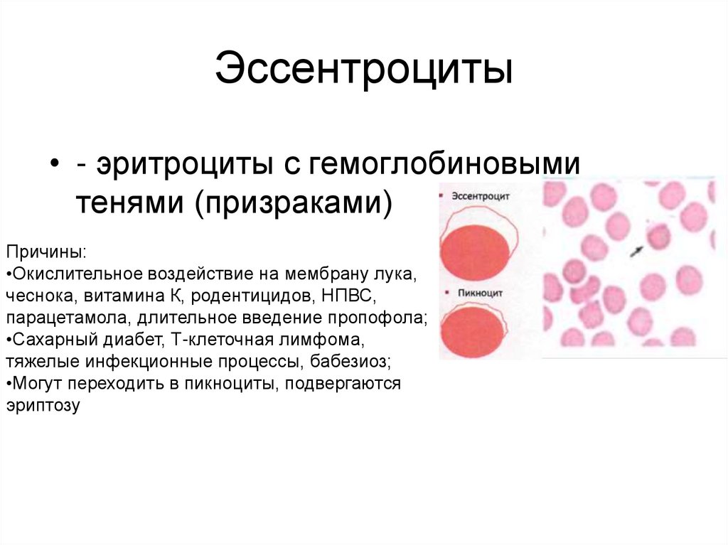 Форма эритроцитов. Патология формы эритроцитов. Классификация патологических эритроцитов. Классификация патологических форм эритроцитов. Стареющие и патологические формы эритроцитов.