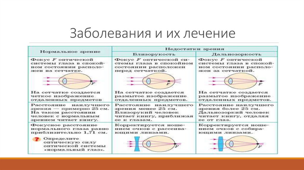 Миопический астигматизм что. Инерционность зрения. Инерция зрения.