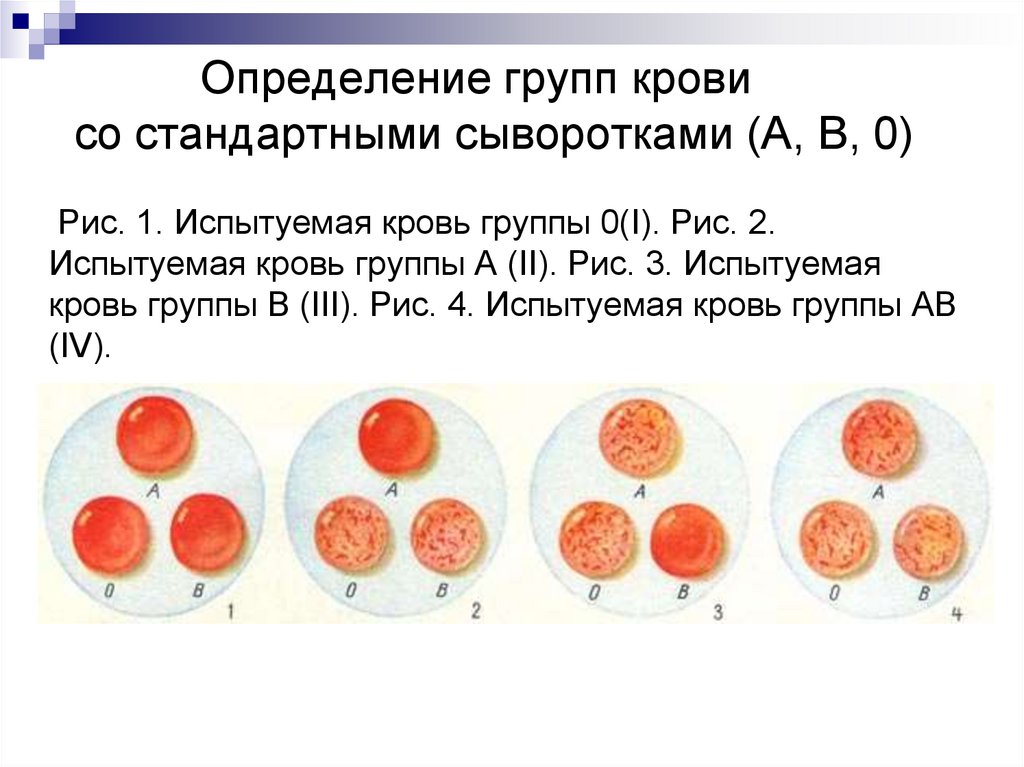 Результаты определения группы крови