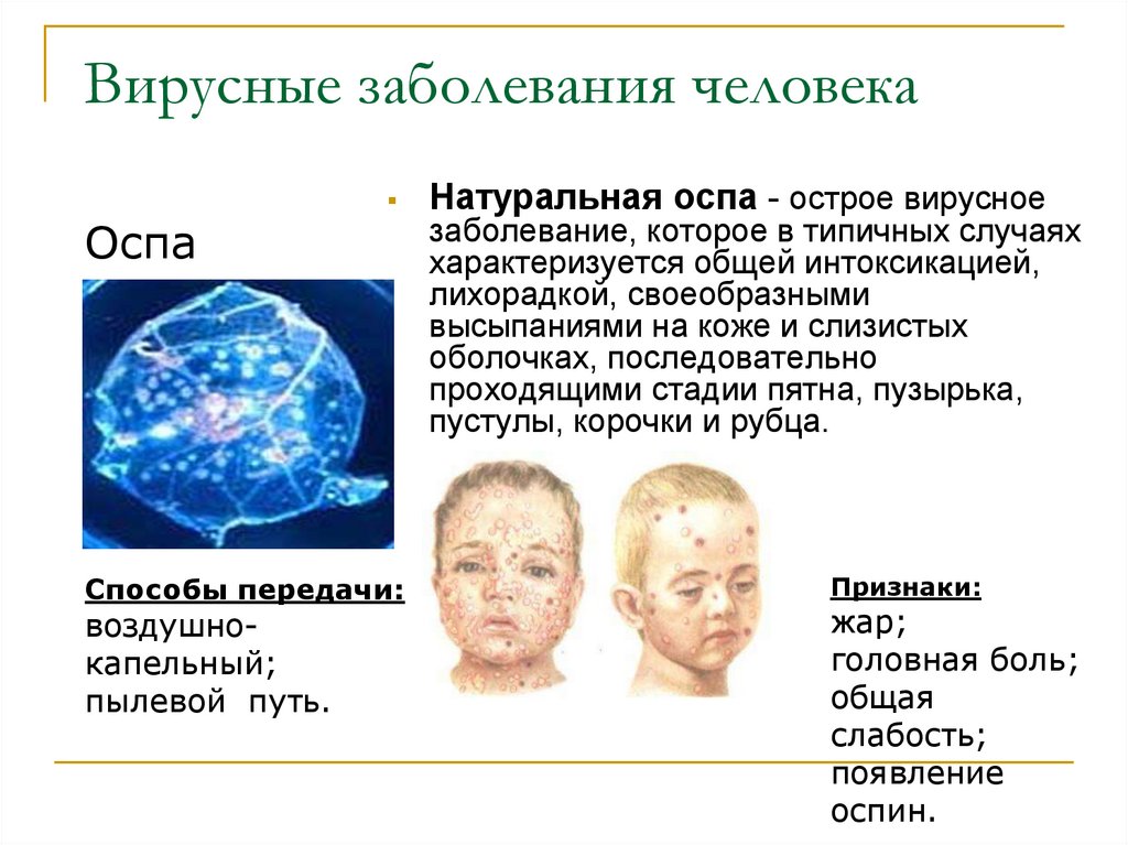 Примеры заболеваний вызываемых вирусами. Вирусные заболевания. Вирусы заболевания человека. Натуральная оспа презентация.