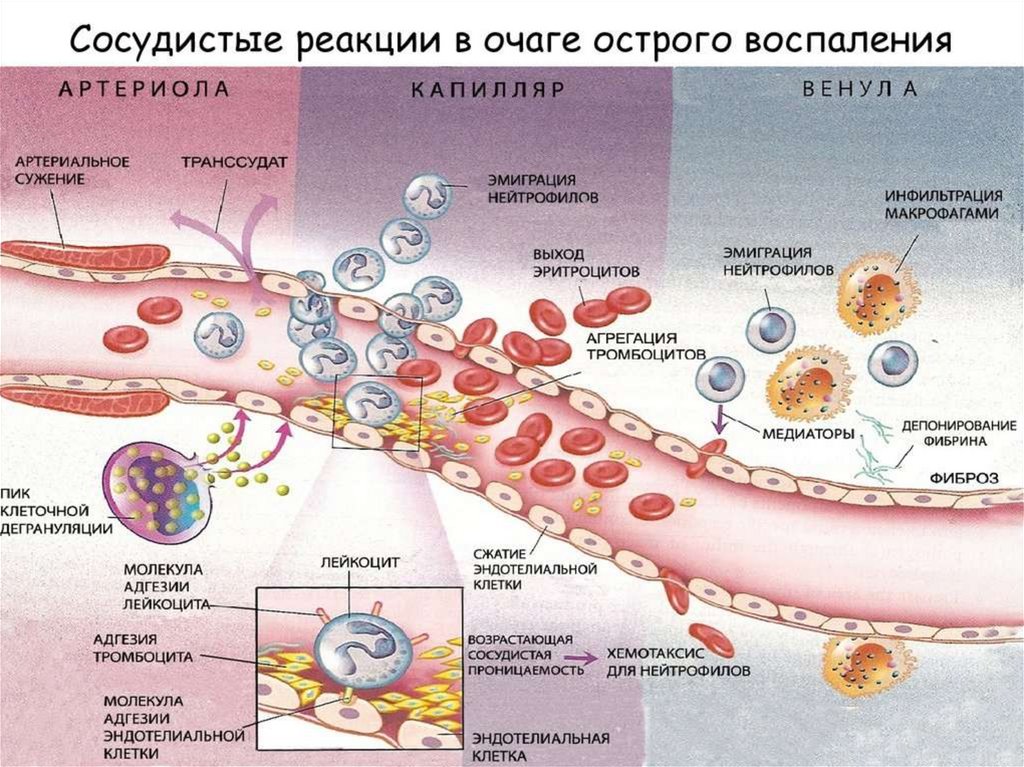 Схемы воспалительную реакцию тканей на внедрение микробов