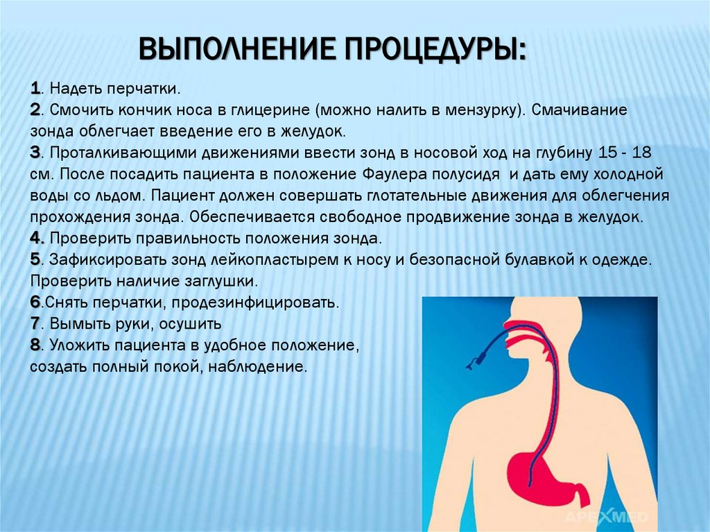 Введение назогастрального зонда. Назогастральный зонд. Показания к назогастральному зонду. Назогастральный зонд рентген. Осложнения при назогастральном зонде.