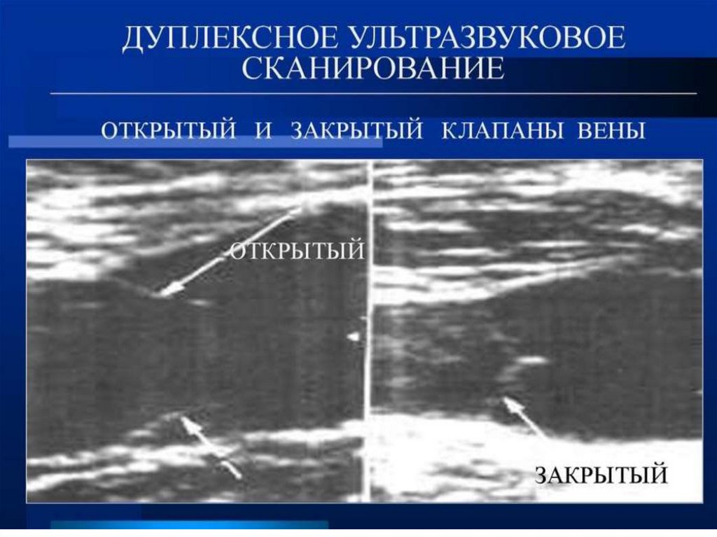 Эндоскопическая хирургия нижних конечностей - презентация онлайн
