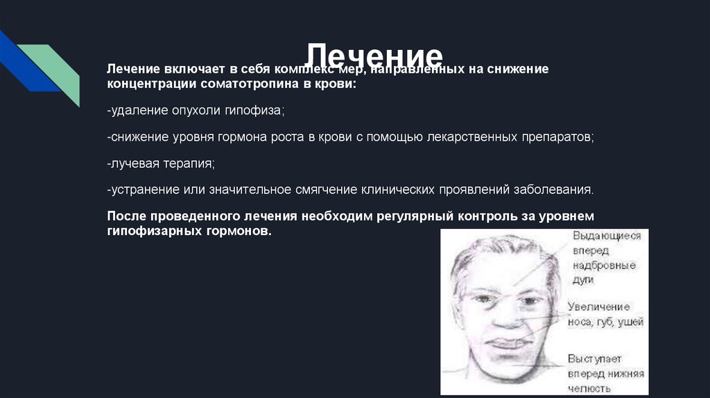 Акромегалия - презентация онлайн