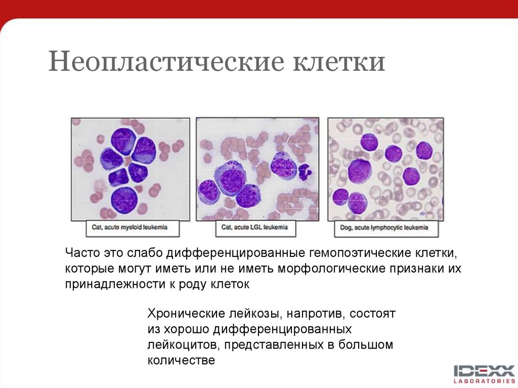 Неопластический процесс. Морфология лейкоцитов гранулоцитов. Нейтрофилы морфология клеток. Морфологические признаки нейтрофилов. Неопластические клетки это.