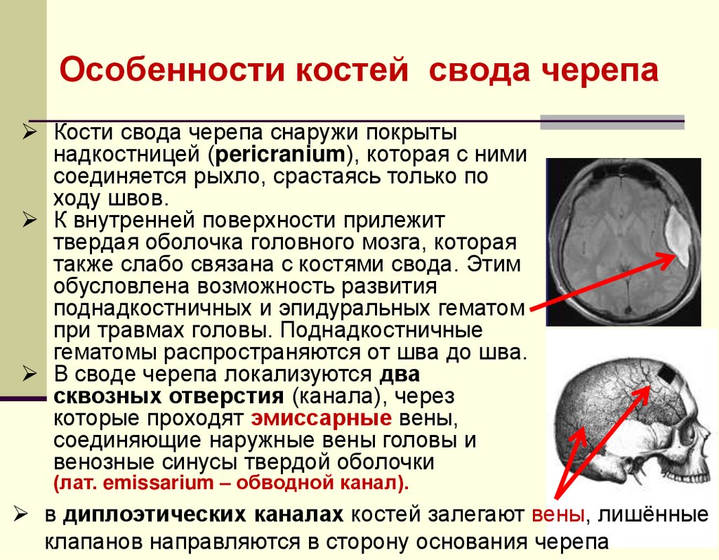 Перелом кости свода черепа. Свод черепа. Особенности строения костей свода черепа. Диплоические вены костей свода черепа. Миелома костей свода черепа.