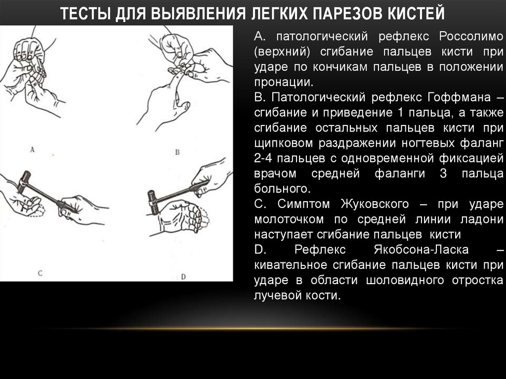 В изображенном на рисунке опыте экспериментатор ударяет пациента неврологическим молоточком