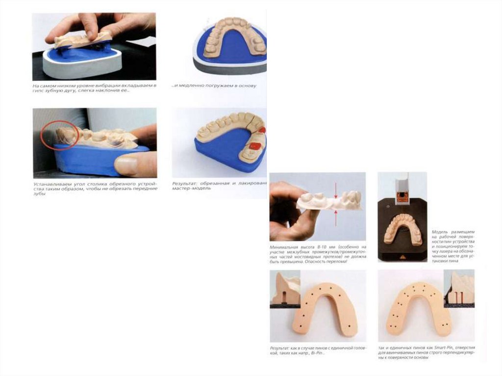 Методы изготовления разборной модели. Пиндекс система изготовления разборной модели. Комбинированная разборная модель. Разборная модель зуботехническая. Разборная модель в стоматологии.