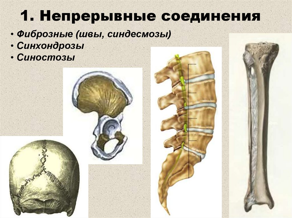 2 кости и их соединения. Соединение костей синдесмозы. Синдесмозы синхондрозы синостозы. Синхондроз синостоз. Непрерывные соединения костей синдесмозы синхондрозы.