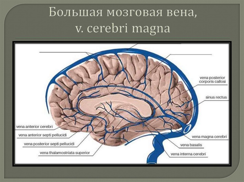 Схема синусов головного мозга