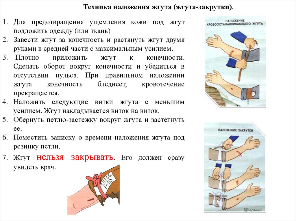 Установите соответствия между видом кровотечения и первой помощью. Кровотечения презентация. Виды кровотечений и первая помощь при них. Установите соответствие видов кровотечений.