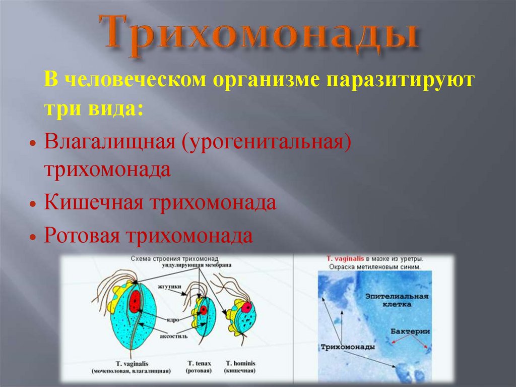 Трихомониаз, трихомонада