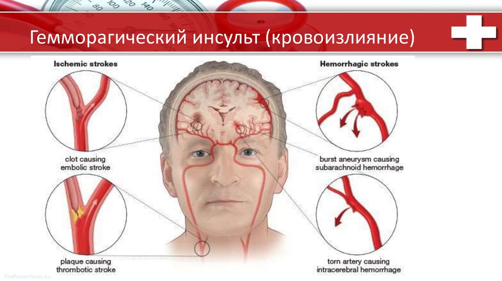 онмк - презентация онлайн