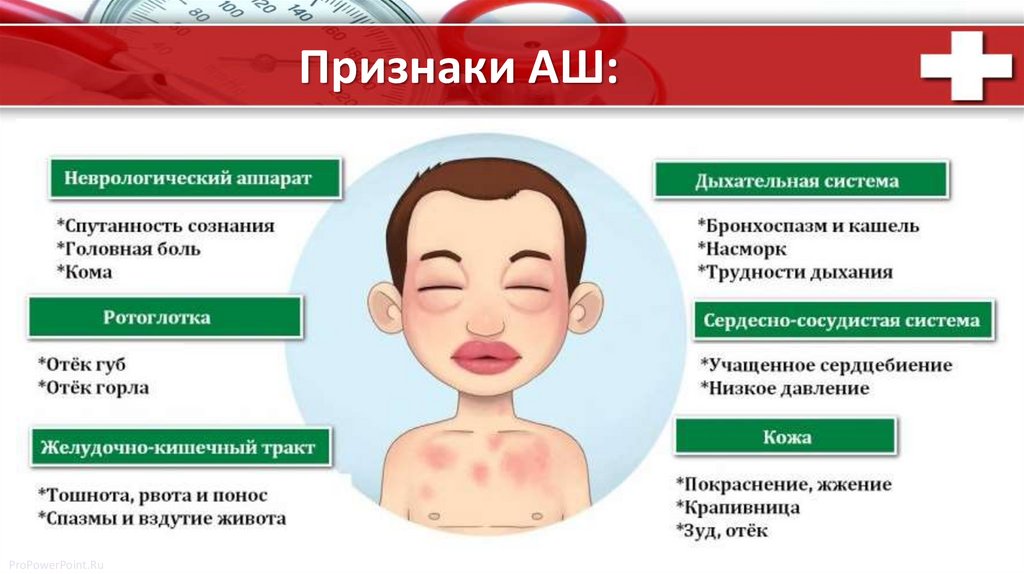 онмк - презентация онлайн