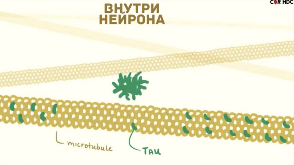 Болезнь Альцгеймера - презентация онлайн