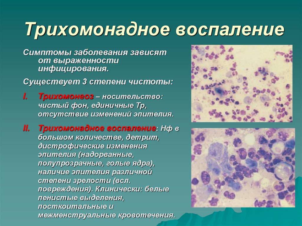 Цитологическая картина воспаления