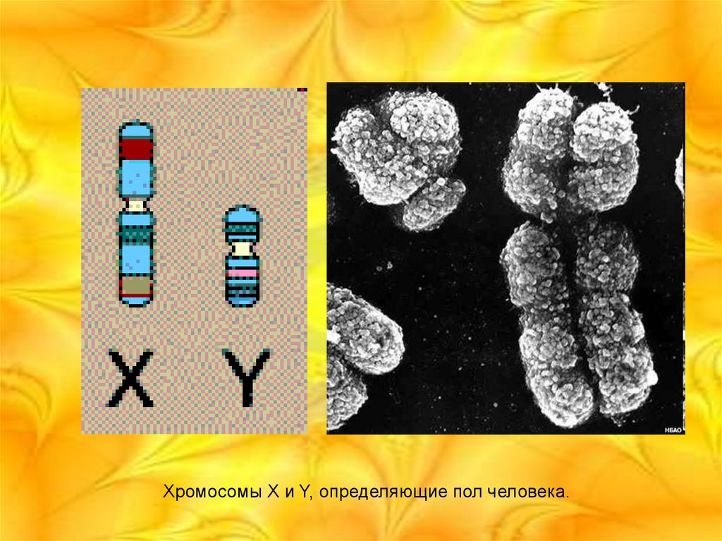 Хромосомы определяют окраску растения. Хромосомы в электронном микроскопе. Строение хромосом в электронном микроскопе. Структура хромосом. Строение хромосом в световом и электронном микроскопах.