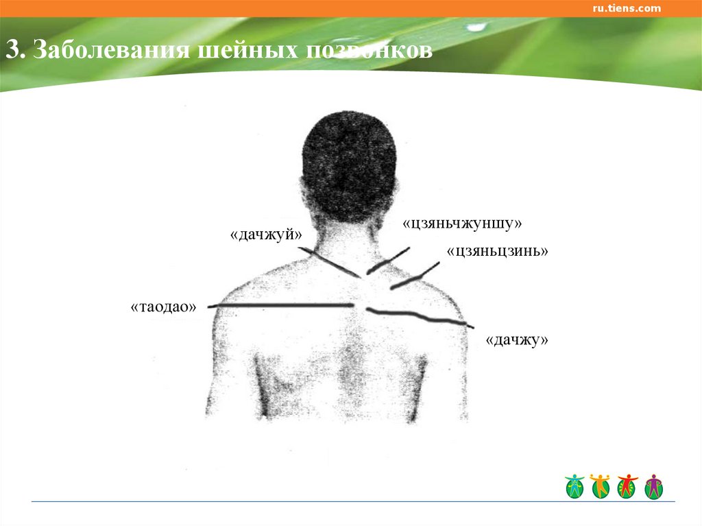 Психосоматика шейного. Акупунктурные точки шейных позвонков. Исюэтун Тяньши. Исюэтун при псориазе.