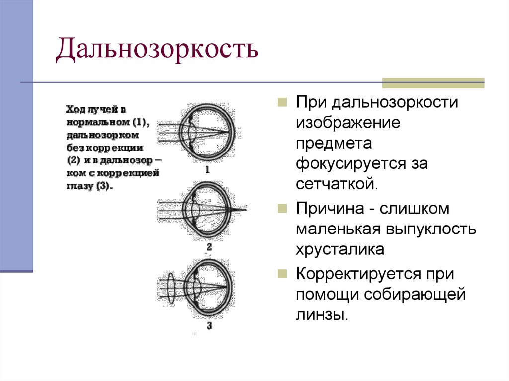 Глаз переворачивает изображение почему