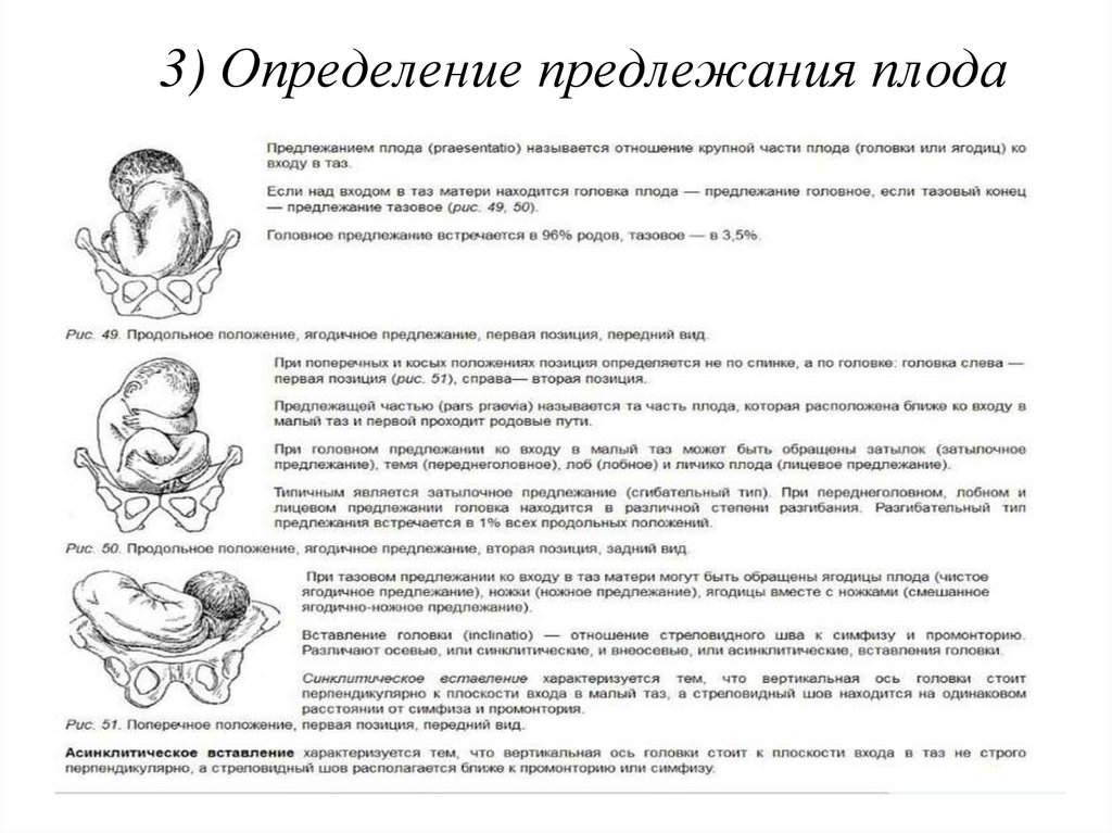 1 позиция плода передний вид. Передний вид предлежания плода. Определение положения плода. Вид и позиция плода в акушерстве.