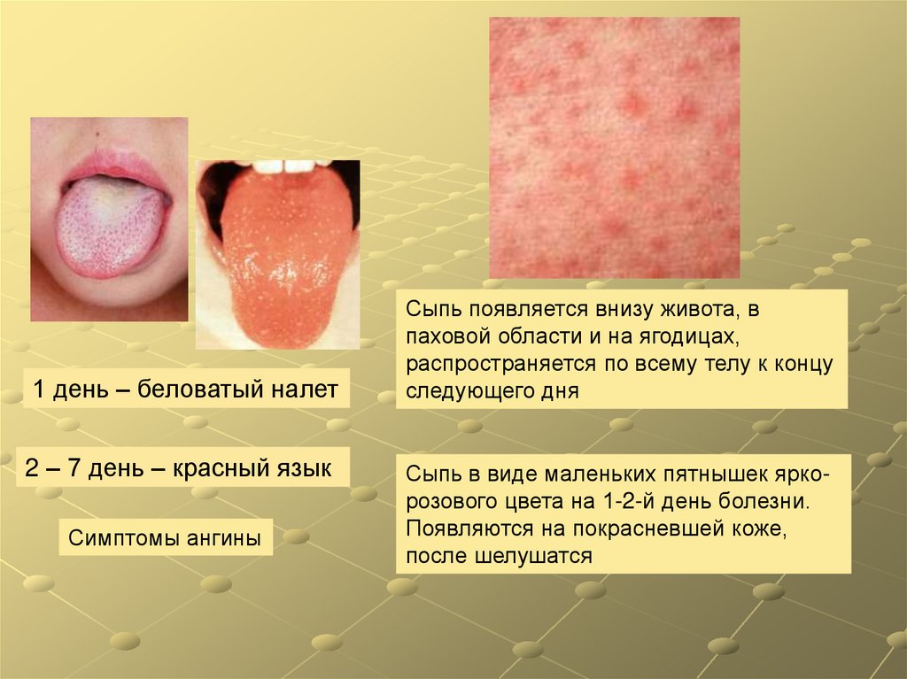 инфекционные заболевания мочеполовой системы у детей