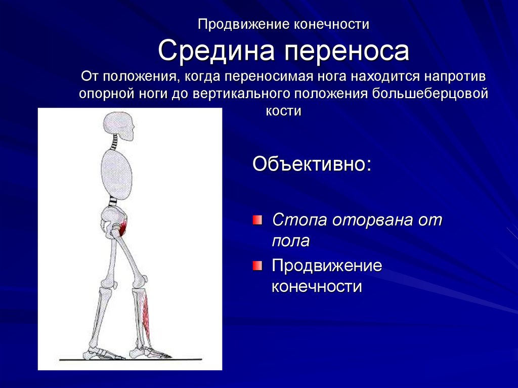 Презентация про переломы