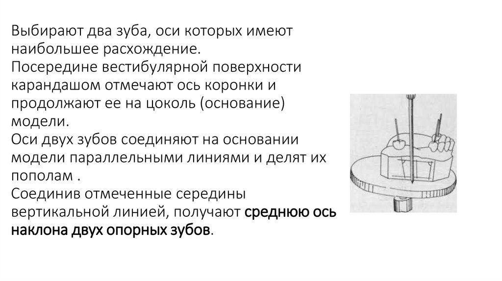 Параллелометрия в ортопедической стоматологии