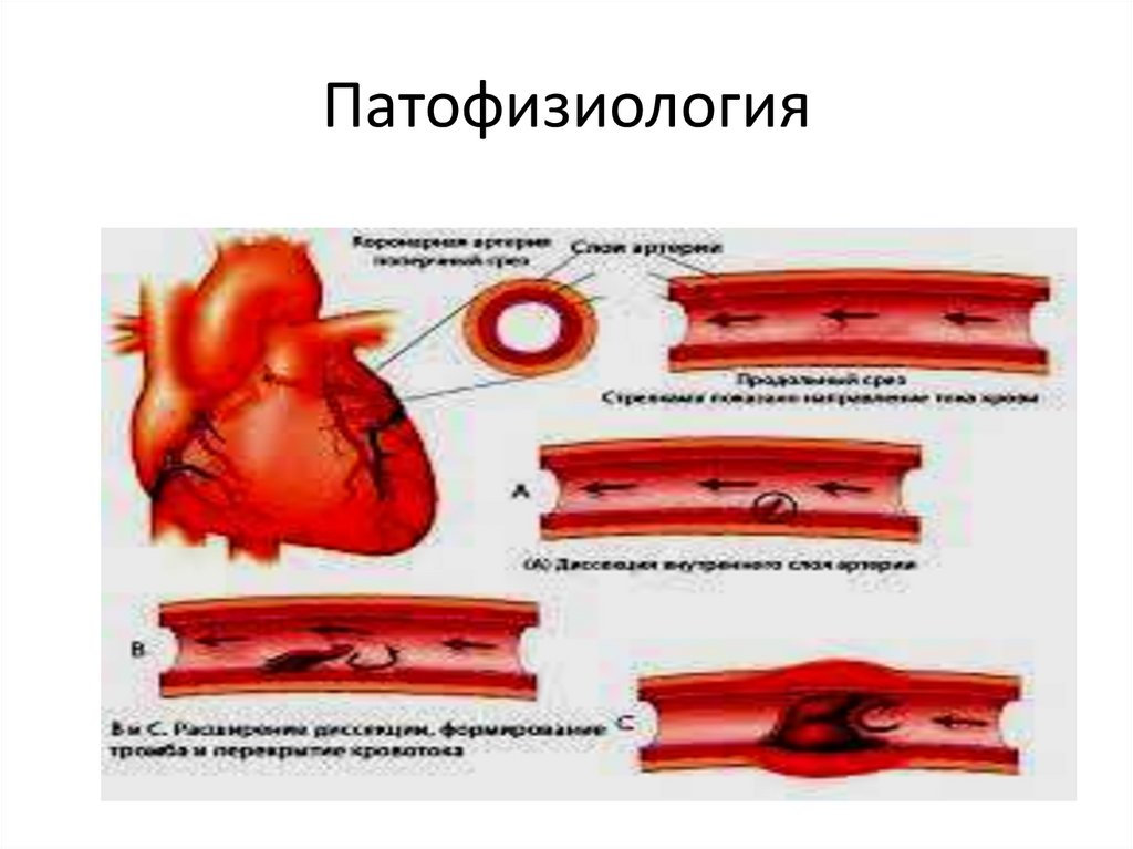 Заболевания сердечно-сосудистой системы - презентация онлайн