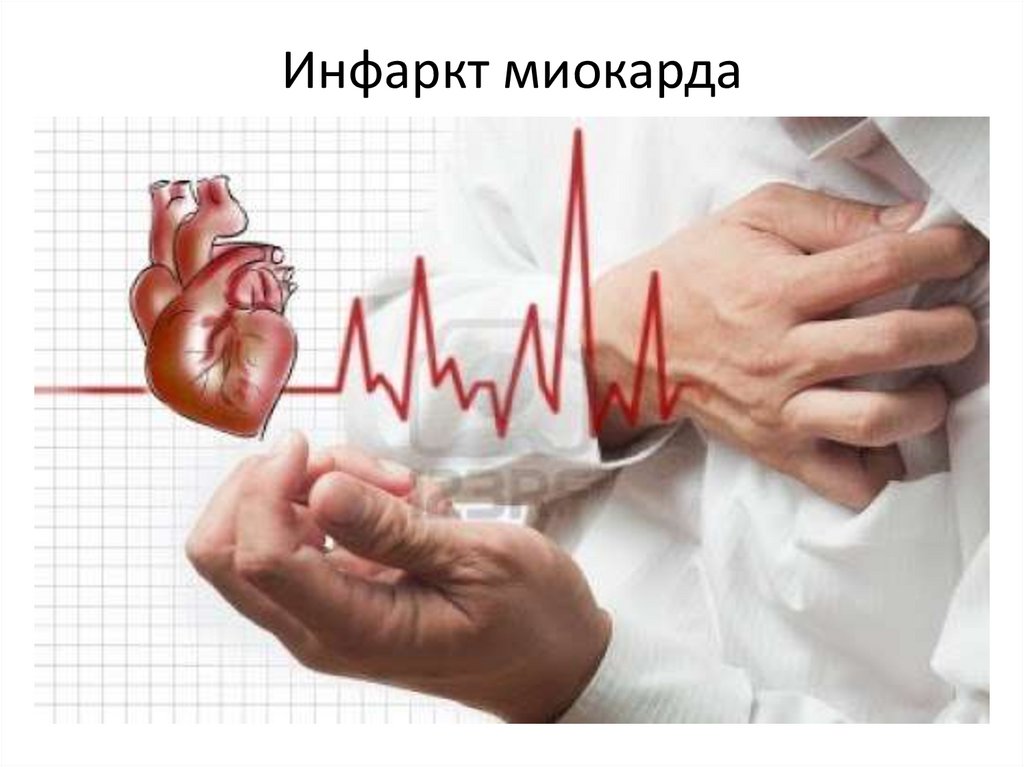 Заболевания сердечно-сосудистой системы - презентация онлайн