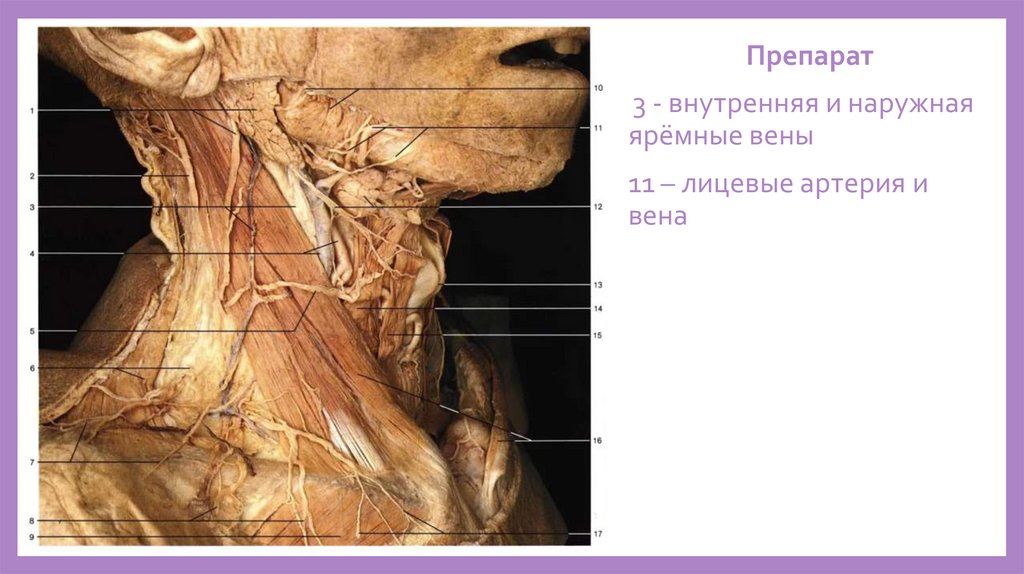 Внечерепные притоки. Внутренней ярёмной вены. Наружная ярёмная вена ...