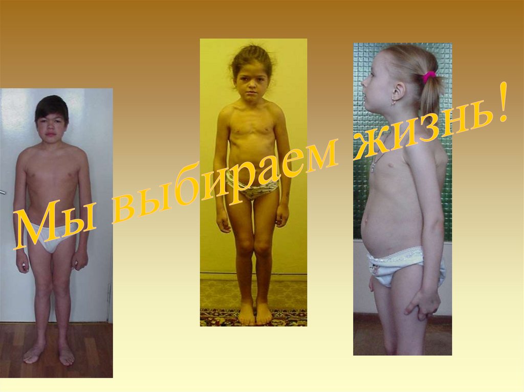 Для оценки роли наследственности и среды в формировании и развитии признака используют формулу Хольцингера: