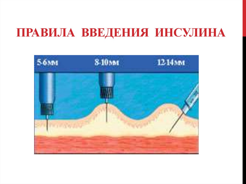 Правила введения