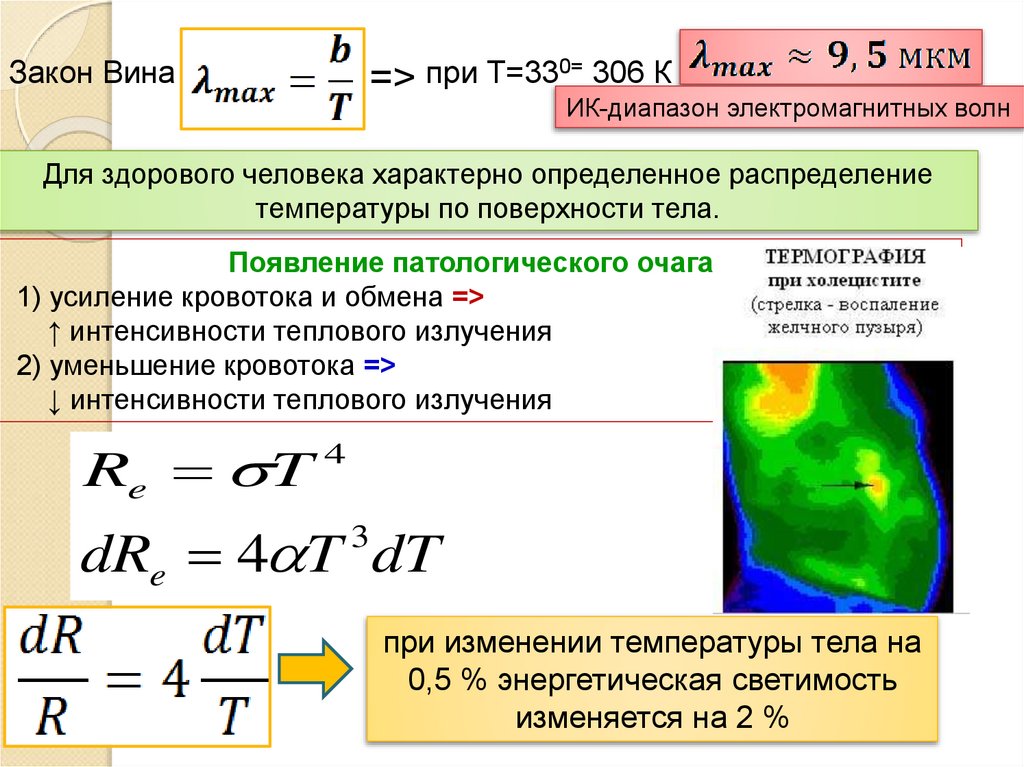 Тепловое излучение света. Тепловое излучение человека. Закон вина для теплового излучения.