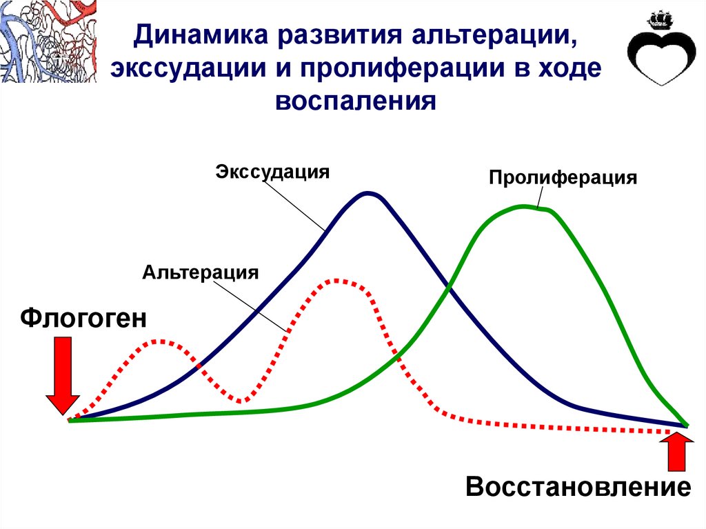 Динамику развития процессов. Фазы воспаления альтерация экссудация пролиферация. Воспаление альтерация экссудация пролиферация. Схема динамики воспалительного процесса. Стадии воспаления альтерация экссудация.