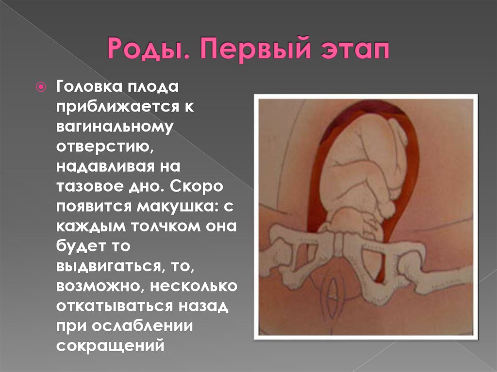Роды. Первый этап