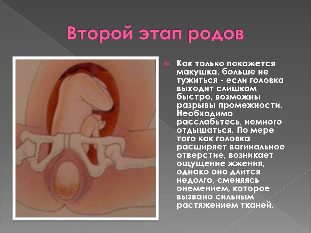 Второй этап родов