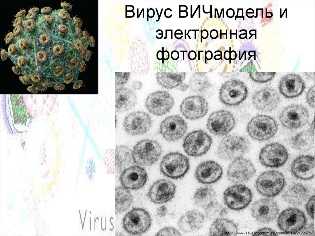 Вирус ВИЧмодель и электронная фотография