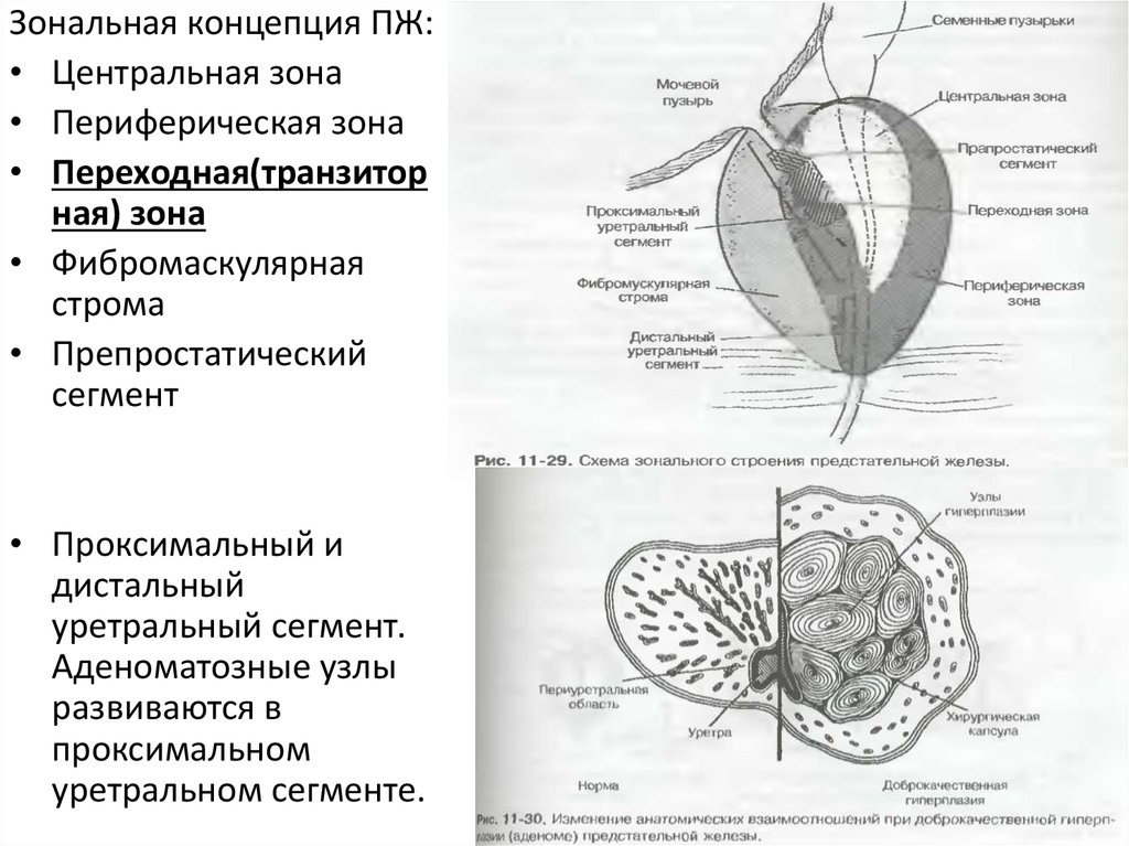 Мудра при аденоме простаты.