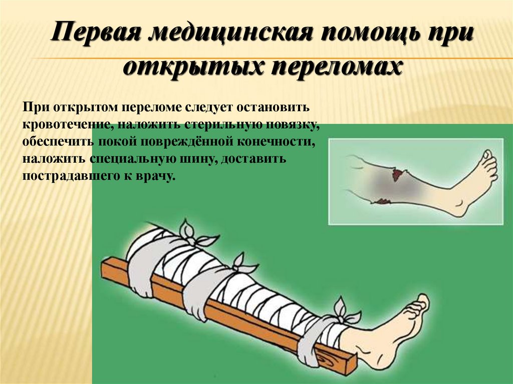 Понятие травм и их виды обж презентация