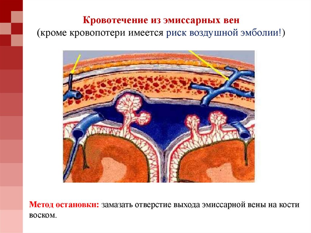 Эмиссарную вен. Оболочки головного мозга эмиссарная вена. Эмиссарную вен. Сосцевидная эмиссарная вена. Эмиссарную вен.