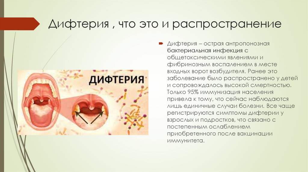 Появление дифтерии в России - презентация онлайн