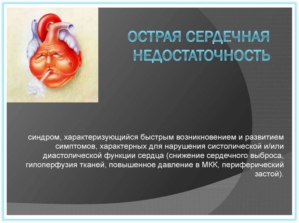 Первая помощь при острой сердечной недостаточности и инсульте ...