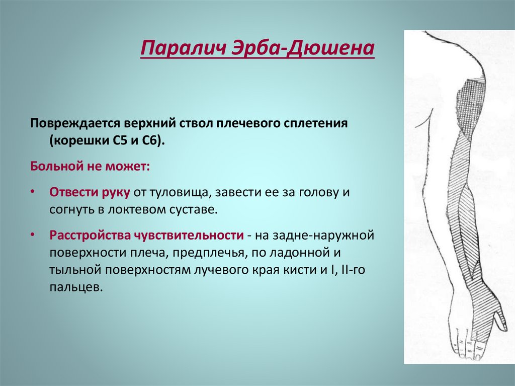 Нарушение чувствительности латынь терминоэлементы. Блокада локтевого лучевого и срединного нервов. Чувствительные расстройства при НБ.