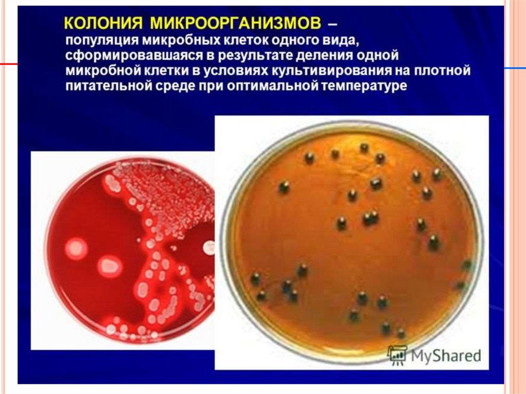 Культивирование клеток человека на питательных средах. Колония это микробиология. Колонии микроорганизмов. Колония микроорганизмов это микробиология. Колония бактерий это в микробиологии.