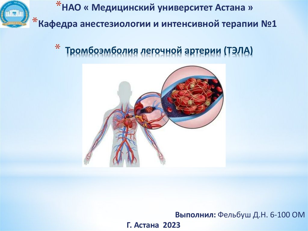 Тромбоэмболия легочной артерии код по мкб
