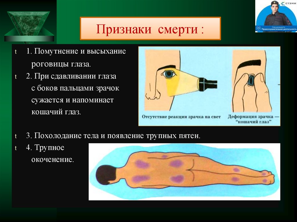 Мероприятия первой помощи признаки жизни