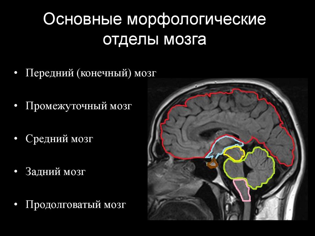 Доли мозга мрт. Анатомия ствола головного мозга мрт. Цистерны головного мозга на мрт анатомия. Мрт норма анатомия головного мозга. Анатомия мозолистого тела головного мозга мрт.