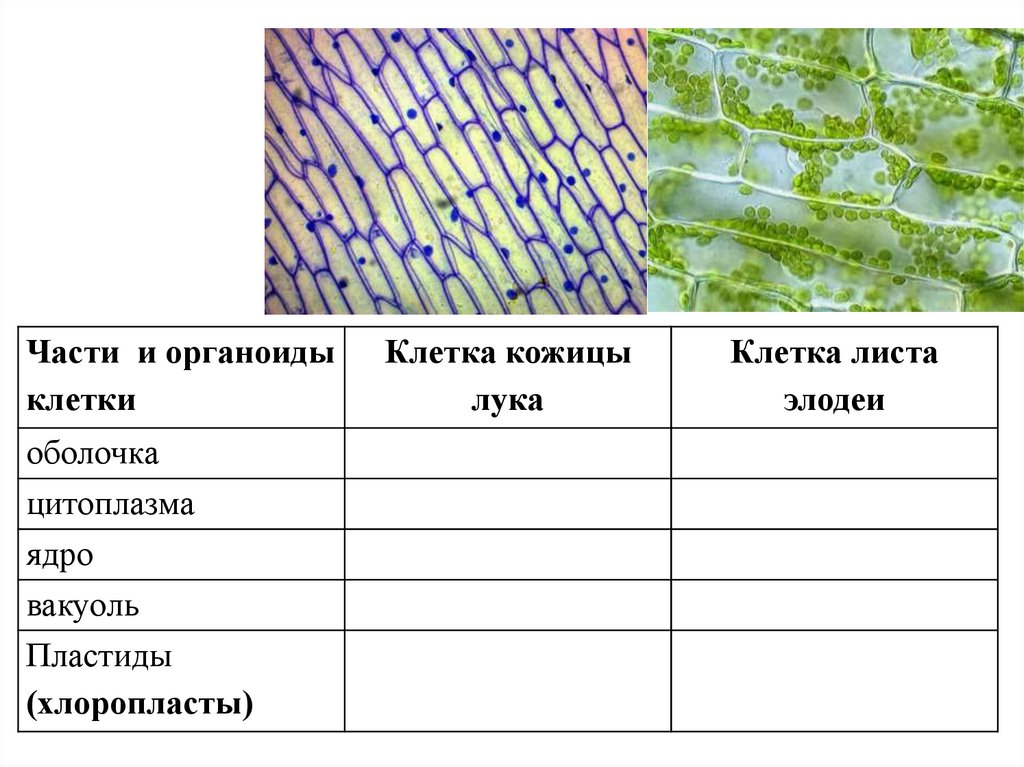 Особенности внутреннего строения элодеи. Изучение микроскопического строения листа. Микроскопическое строение листа элодеи. Ламинария строение микроскопическое строение у нее.