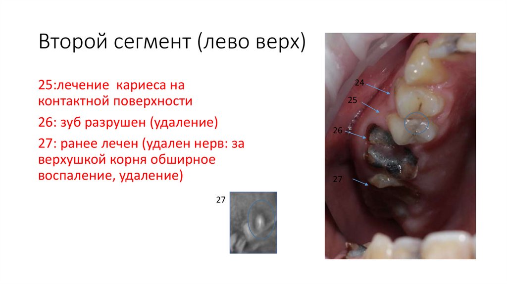 План лечения Рябцова Дмитрия Михайловича (1 этап лечения: санация ...