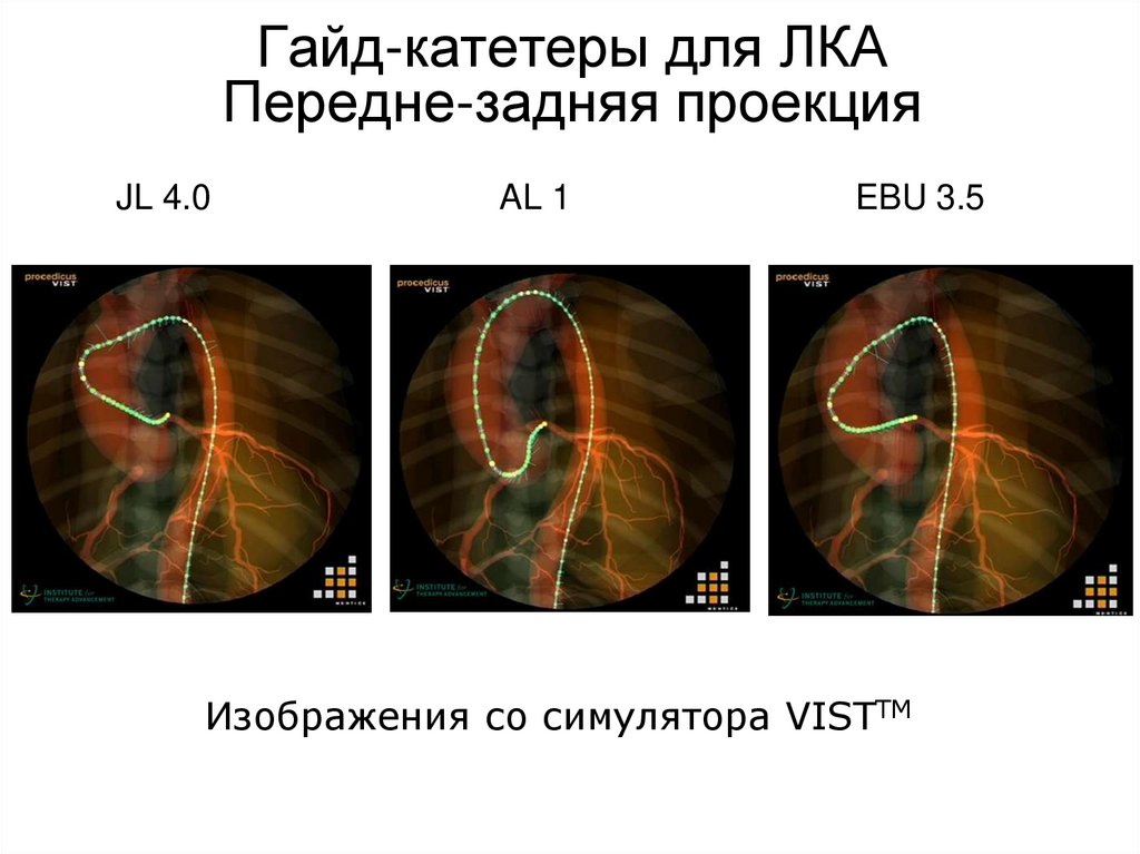 Задняя проекция